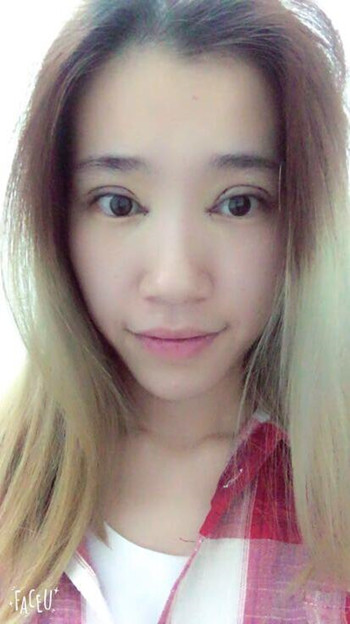 做了全切雙眼皮 整個(gè)眼睛都變大了氣質(zhì)也不一樣了