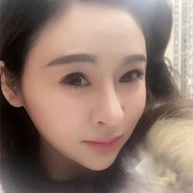 自體脂肪填充面部前后過程以及對比照片，真實案例分享