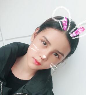 上海韓鏡網(wǎng)紅套餐半個(gè)月經(jīng)歷 雙眼皮多項(xiàng)整形+隆鼻整形+脂肪填充