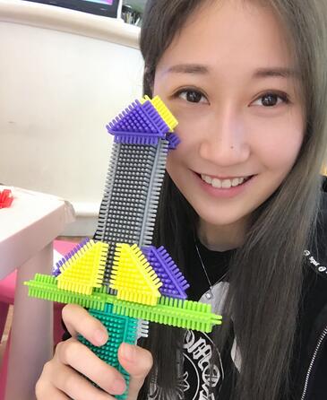 埋線雙眼皮七天恢復(fù)圖