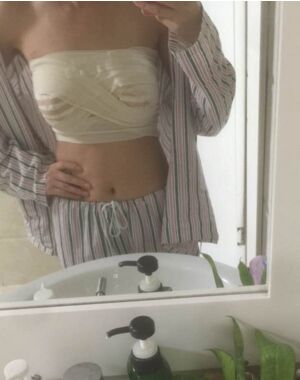 羅志敏做的曼托假體隆胸果很滿意