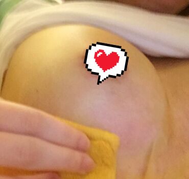 自體脂肪隆胸落實(shí)我擁有豐滿(mǎn)美胸的愿望