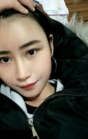 馮斌做的自體脂肪全臉填充大家?guī)臀铱纯垂趺礃? /> </a>
										<a href=