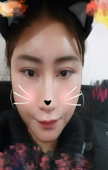 馮斌做的自體脂肪全臉填充大家?guī)臀铱纯垂趺礃? /> </a>
									</div>
								</dd>
							</dl><dl>
								<dt>
							<a href=