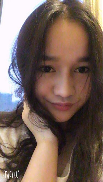 做了隆鼻整形手術整個鼻子靈巧了許多 快來圍觀果