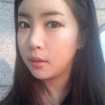 分享美立方做下頜角整形手術(shù)經(jīng)歷，還有前后對比果圖片哦~