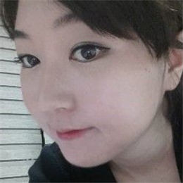 下頜角整形手術(shù)前后對比果圖片分享，還有恢復過程心路歷程~~~