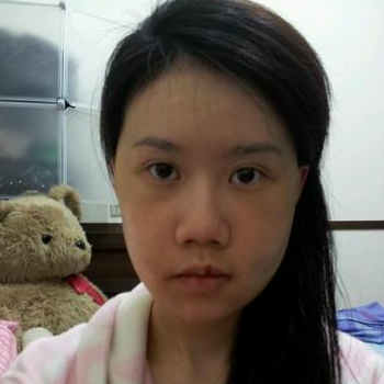 磨下頜角面部輪廓整形上個月，分享恢復(fù)過程和對比照片哦~