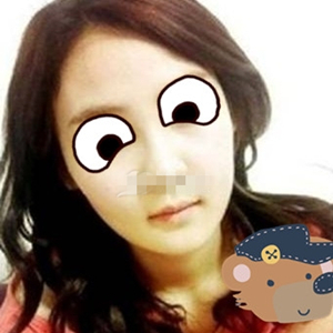 南相宰磨下頜角手術(shù)恢復(fù)過程分享，還有前后對比圖片哦~