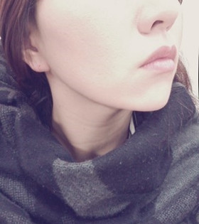 電波l皮緊膚除皺，的確是年輕了不少