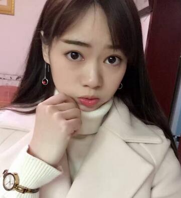 深圳晨曦三點(diǎn)定位雙眼皮日記