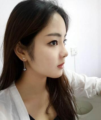 深圳晨曦隆鼻整形半年了 看看果