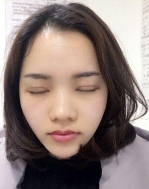 為了美麗大眼做了切開(kāi)雙眼皮，果令我驚嘆