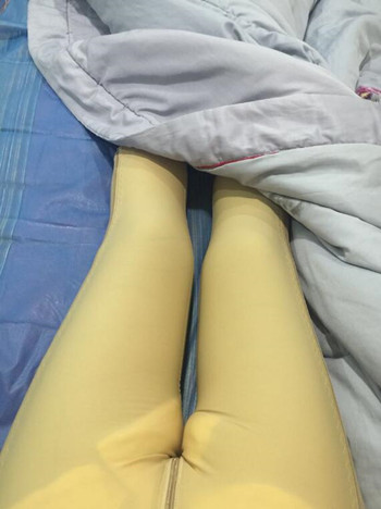 馮斌幫我做的大腿吸脂 果真的很棒