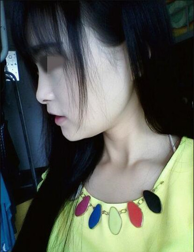 終于做了磨下頜角拯救了我的國字臉