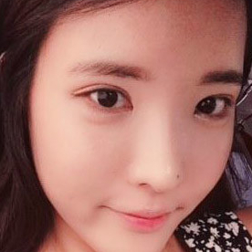 鷹鉤鼻矯正整形手術(shù)恢復(fù)過程和前后對比果圖片，分享給大家~