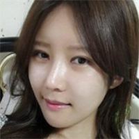 做了埋線雙眼皮、隆鼻、磨下頜角，兩個(gè)月了，分享恢復(fù)照片~