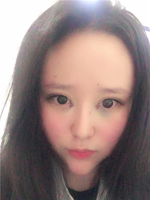 開了眼角之后，眼睛變得很勾人