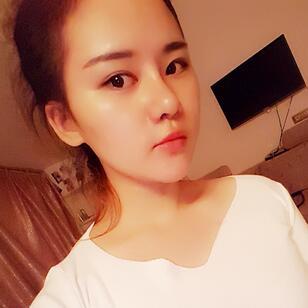 假體墊下巴一個月 前后對比