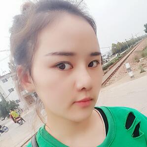 假體墊下巴一個月 前后對比