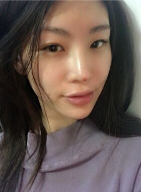 線D隆鼻恢復過程圖，看看我的果怎么樣