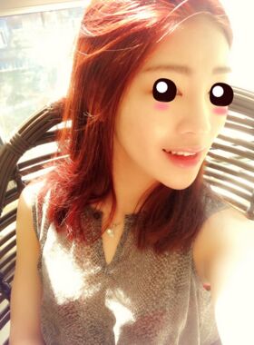 線D隆鼻恢復過程圖，看看我的果怎么樣