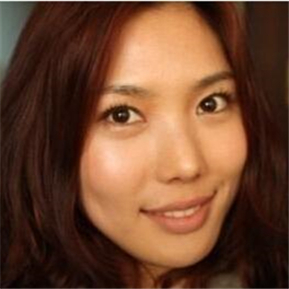 武漢希思特做了埋線法雙眼皮、開內(nèi)眼角和鼻尖移植軟骨整形手術(shù)~