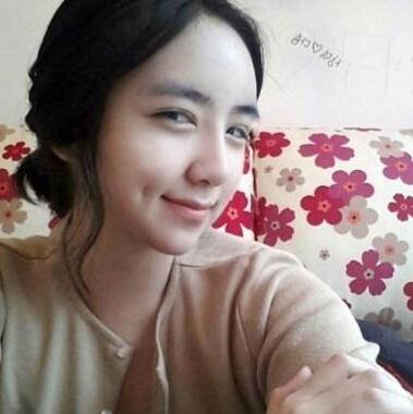 切開雙眼皮和硅膠假體隆鼻手術(shù)前后對(duì)比果圖片分享~