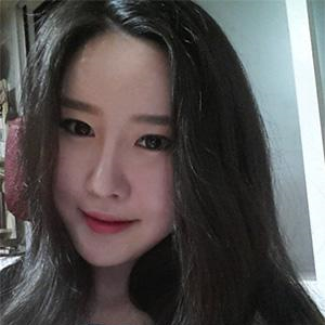 自體軟骨墊鼻尖手術(shù)前后對(duì)比果照片分享，看我的恢復(fù)過(guò)程~