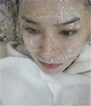 元旦做的光子嫩膚，分享恢復(fù)過(guò)程和前后對(duì)比果照片哦~