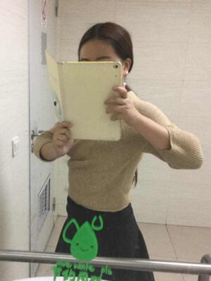 腰腹吸脂減肥果很好，恢復圖分享