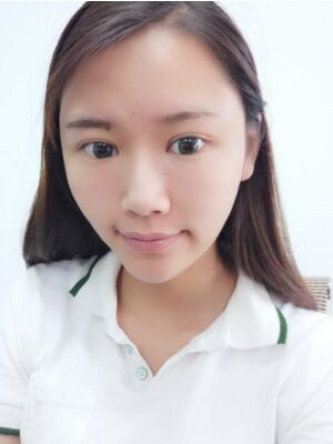 自體脂肪面部填充后恢復(fù)，成活率還蠻高的