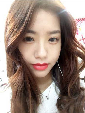 玻尿酸豐下巴果還不錯 過幾個月就做假體隆下巴