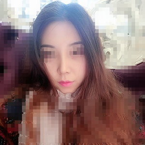 吸脂瘦臉手術半年了，分享前后對比果照片~