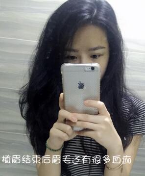 眉毛種植果和成長(zhǎng)過程分享