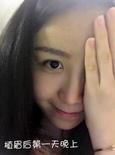 眉毛種植價(jià)格4800元，植眉果和成長(zhǎng)過程分享