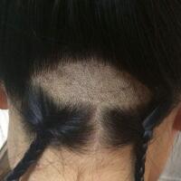 眉毛種植果和整形圖片分享