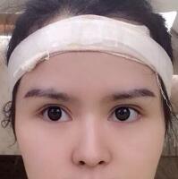 眉毛種植果和整形圖片分享