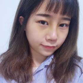 去年11月做的膨體隆鼻手術(shù)，終于擺脫我的塌鼻梁了