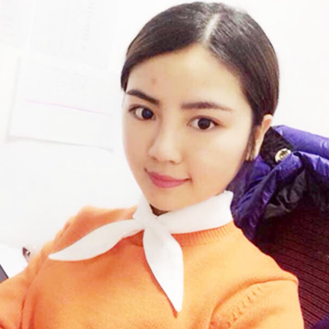 磨下頜角磨顴骨手術(shù)恢復(fù)過程和前后對比果照片分享哦~