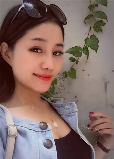 我做自體脂肪隆鼻手術(shù)恢復(fù)過程和前后對比果圖片分享哦~