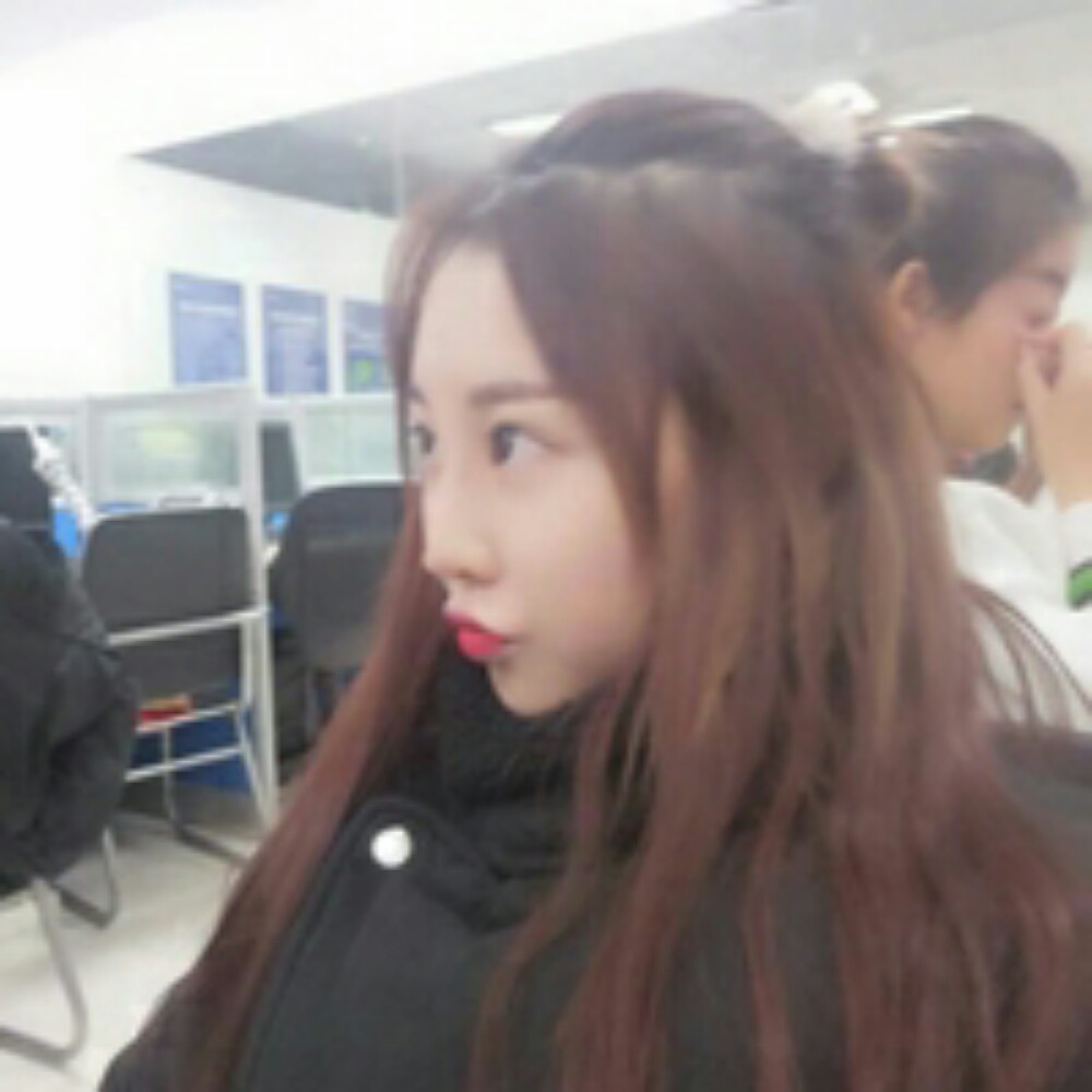 耳軟骨隆鼻尖+自體脂肪填充全臉恢復(fù)前后對比果照片分享~