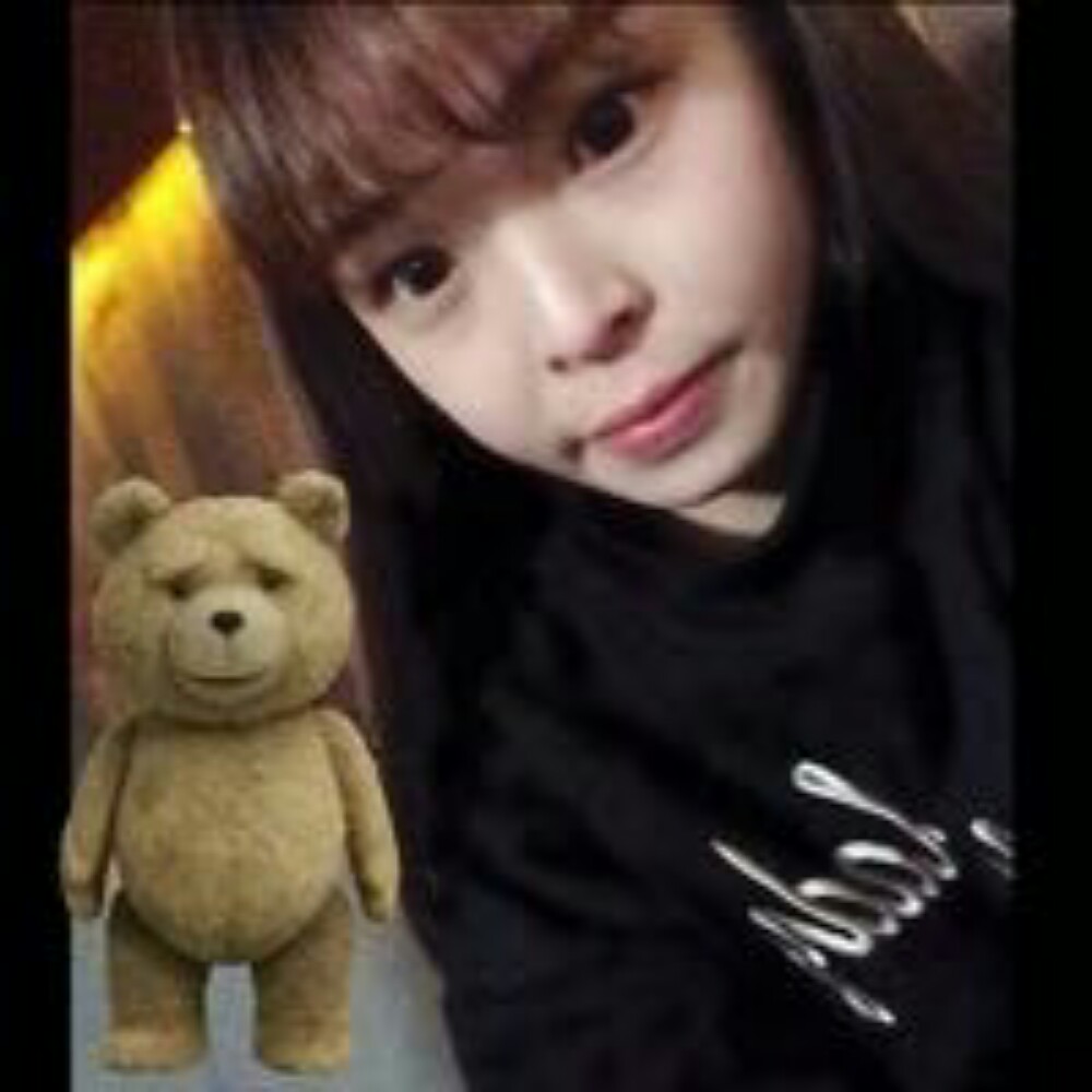 玻尿酸注射墊下巴和隆鼻前后對比果圖片分享，孫中生做的~