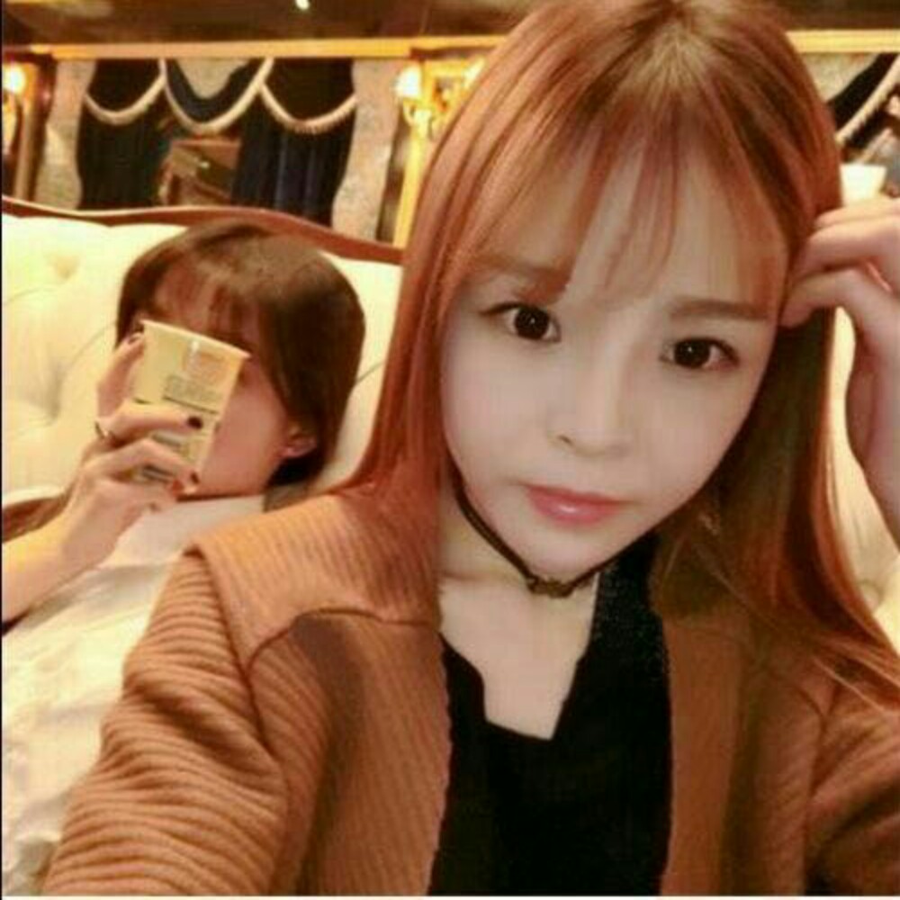 玻尿酸注射墊下巴和隆鼻前后對比果圖片分享，孫中生做的~