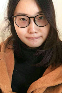 下頜角切除手術之后，我也變成小V臉了!