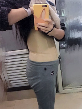腰腹吸脂手術后，我也擁有“小蠻腰”啦!
