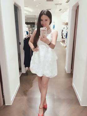 腰腹吸脂手術后，我也擁有“小蠻腰”啦!