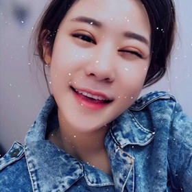 切開雙眼皮+開內(nèi)眼角手術(shù)前后過程，還有對(duì)比照片喲!