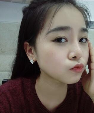 隆鼻整形日記 重慶鉑生硅膠隆鼻＋耳軟骨鼻尖