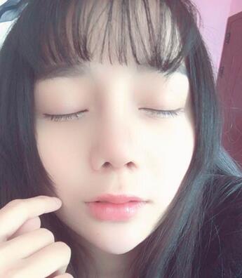 隆鼻修復(fù)術(shù)后恢復(fù)期經(jīng)歷